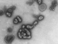 Slovenija: Prvi slučaj virusa H1N1