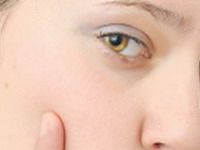 Kako smanjiti proširene pore na licu