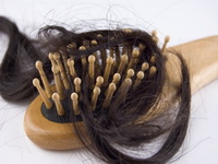 Šta sve može izazvati pojačano ispadanje kose?