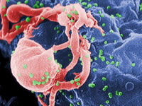 U Srbiji od HIV-a obolelo više muškaraca