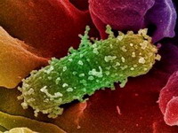 U Švedskoj umrla prva žrtva Escherichije coli izvan Njemačke