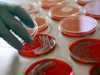 Procjena rizika u vezi kontaminacije hrane uzrokovane E. Coli