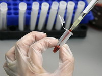 Novi test otkriva genetske bolesti